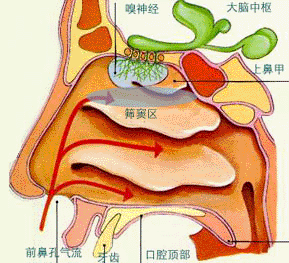 鼻窦炎1.gif